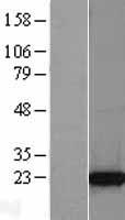 TCTP (TPT1) Human Over-expression Lysate