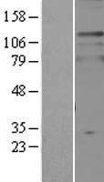 TPD52L2 Human Over-expression Lysate