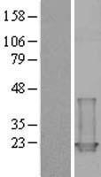 Troponin C1 (TNNC1) Human Over-expression Lysate
