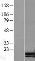 Troponin C (TNNC2) Human Over-expression Lysate