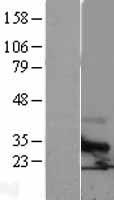 TSPAN6 Human Over-expression Lysate