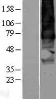 TM7SF1 (GPR137B) Human Over-expression Lysate