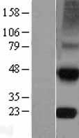 TIMP4 Human Over-expression Lysate