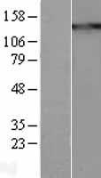 Thrombospondin 1 (THBS1) Human Over-expression Lysate