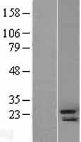 Cripto1 (TDGF1) Human Over-expression Lysate