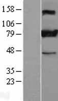 Stromal interaction molecule 1 (STIM1) Human Over-expression Lysate