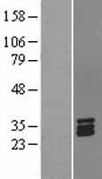 Stanniocalcin 1 (STC1) Human Over-expression Lysate