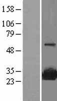 SR1 (SRI) Human Over-expression Lysate