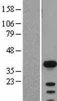 SOX2 Human Over-expression Lysate