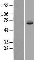 SNX2 Human Over-expression Lysate