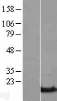 beta Synuclein (SNCB) Human Over-expression Lysate