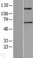 SLC9A2 Human Over-expression Lysate