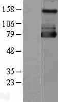 SLC9A1 Human Over-expression Lysate