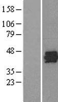 SET Human Over-expression Lysate
