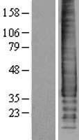 Syndecan 2 (SDC2) Human Over-expression Lysate