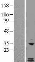 GCP2 (CXCL6) Human Over-expression Lysate
