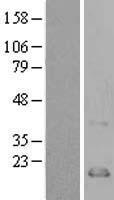 Exodus 2 (CCL21) Human Over-expression Lysate