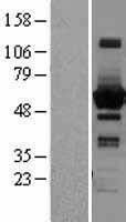 Sterol carrier protein 2 (SCP2) Human Over-expression Lysate