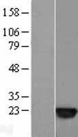 SAT1 Human Over-expression Lysate