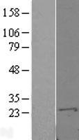 S100A10 Human Over-expression Lysate
