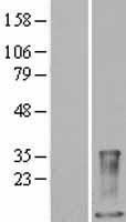 Calprotectin (S100A9) Human Over-expression Lysate