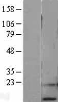 RPA14 (RPA3) Human Over-expression Lysate