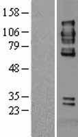PTP alpha (PTPRA) Human Over-expression Lysate