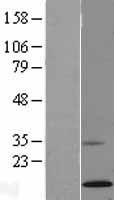Ribonuclease A (RNASE1) Human Over-expression Lysate