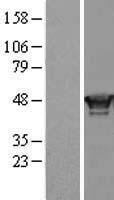 RING1 Human Over-expression Lysate
