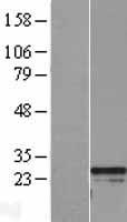 RGS2 Human Over-expression Lysate