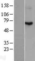 Radixin (RDX) Human Over-expression Lysate