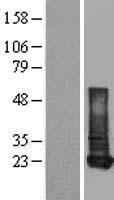 RBP1 Human Over-expression Lysate