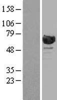 RANGAP1 Human Over-expression Lysate