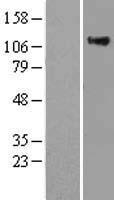 RASA1 Human Over-expression Lysate