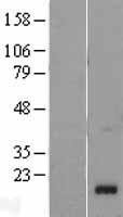 Chemerin (RARRES2) Human Over-expression Lysate