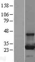 RAB13 Human Over-expression Lysate