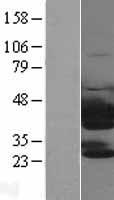 PTK9 (TWF1) Human Over-expression Lysate