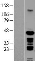 PSMC6 Human Over-expression Lysate