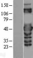 PSMC3 Human Over-expression Lysate