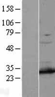 PSMA7 Human Over-expression Lysate