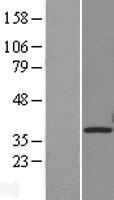 Protein kinase Y linked (PRKY) Human Over-expression Lysate
