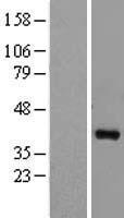 MEK6 (MAP2K6) Human Over-expression Lysate