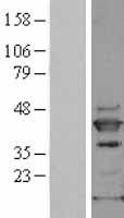 SAPK4 (MAPK13) Human Over-expression Lysate