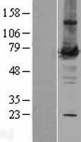 PKC zeta (PRKCZ) Human Over-expression Lysate