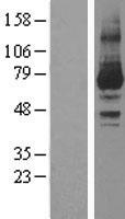 PKC iota (PRKCI) Human Over-expression Lysate