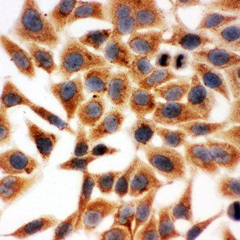 HSD17B1 Rabbit Polyclonal Antibody