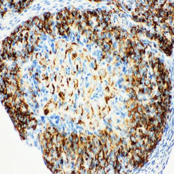 HSD17B1 Rabbit Polyclonal Antibody