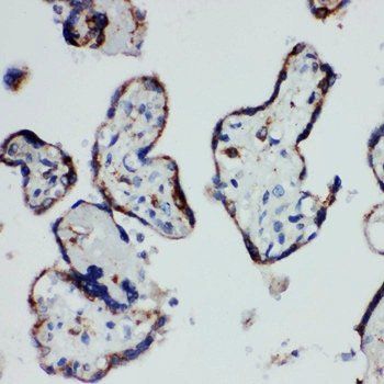 HSD17B1 Rabbit Polyclonal Antibody