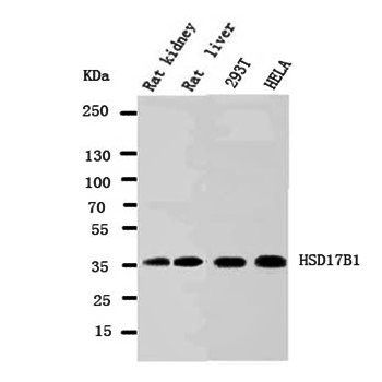 HSD17B1 Rabbit Polyclonal Antibody