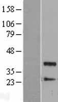 Protein Phosphatase 1 beta (PPP1CB) Human Over-expression Lysate
